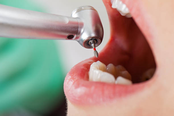 Best Emergency Treatment for Toothache in South Dennis, NJ